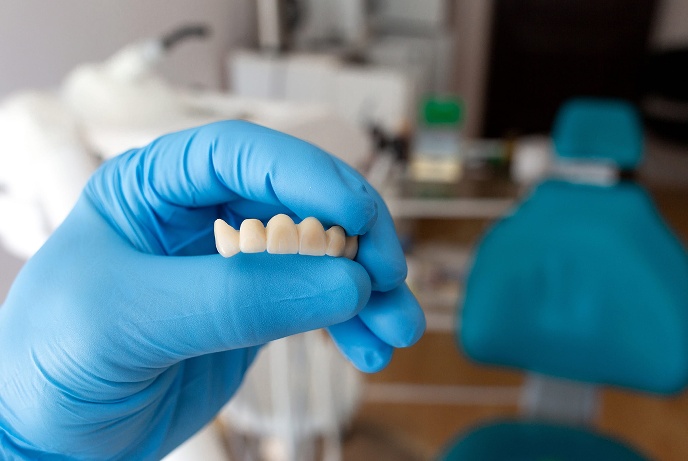 Benefits of Dental Crowns & Bridges