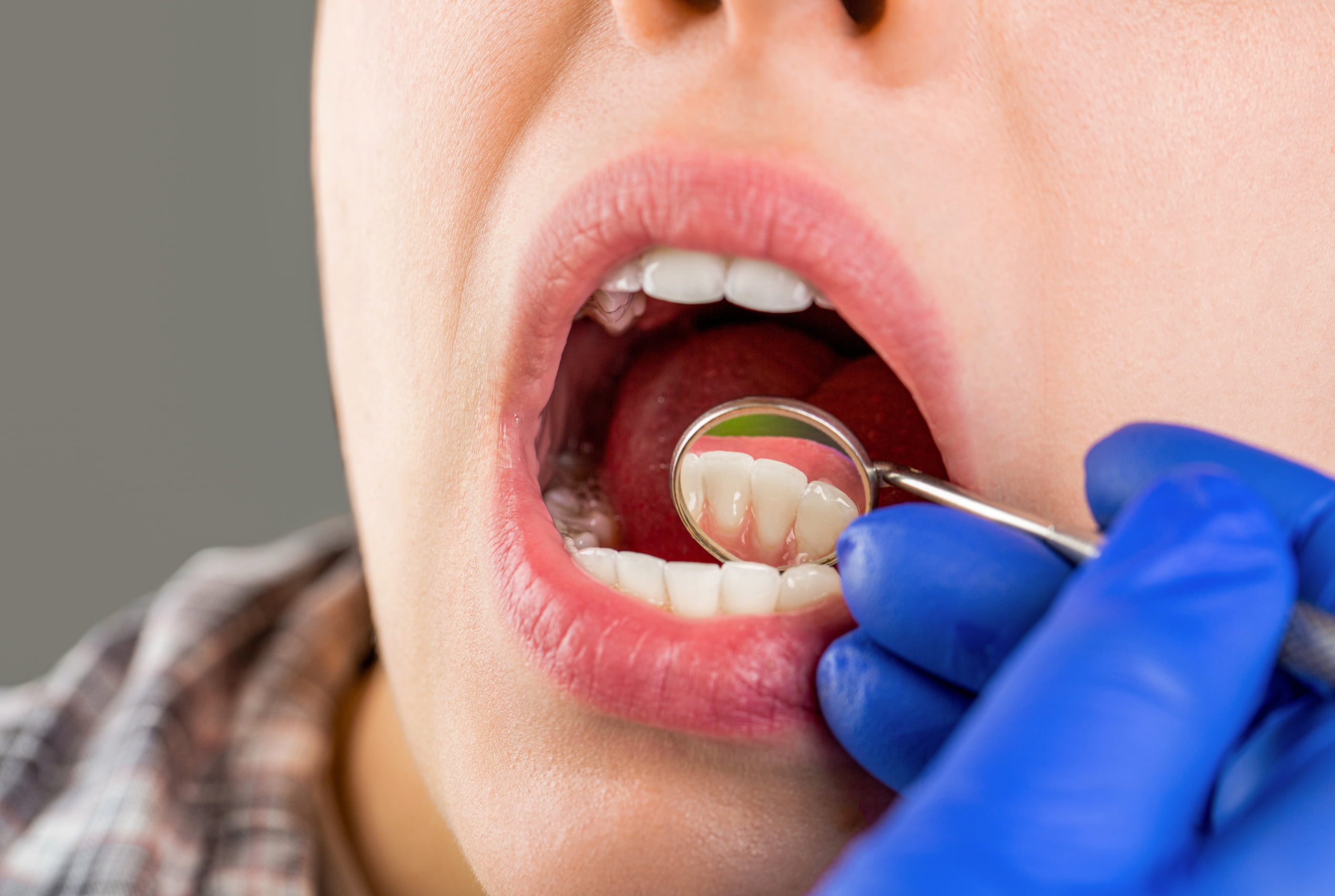 Six-month dental exams with personalized preventive care.