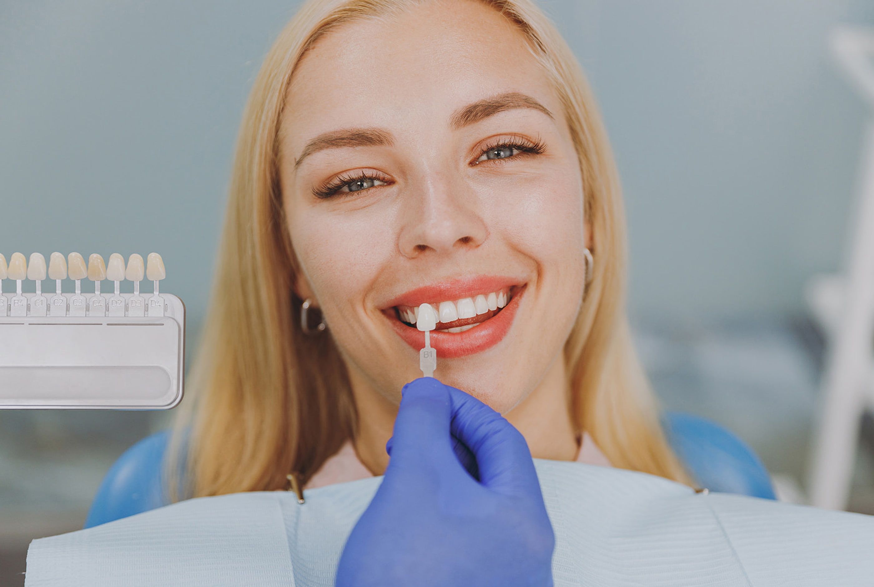 Benefits of Porcelain Veneers